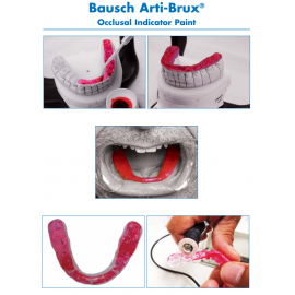 Bausch Arti-Brux® Occlusal Indicator Paint Set