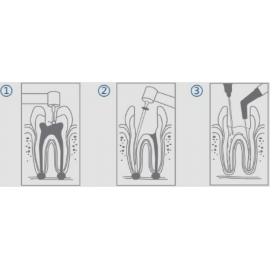 [FLASH SALE] Cotisen Endodontic Aspirator Tip (20pcs)